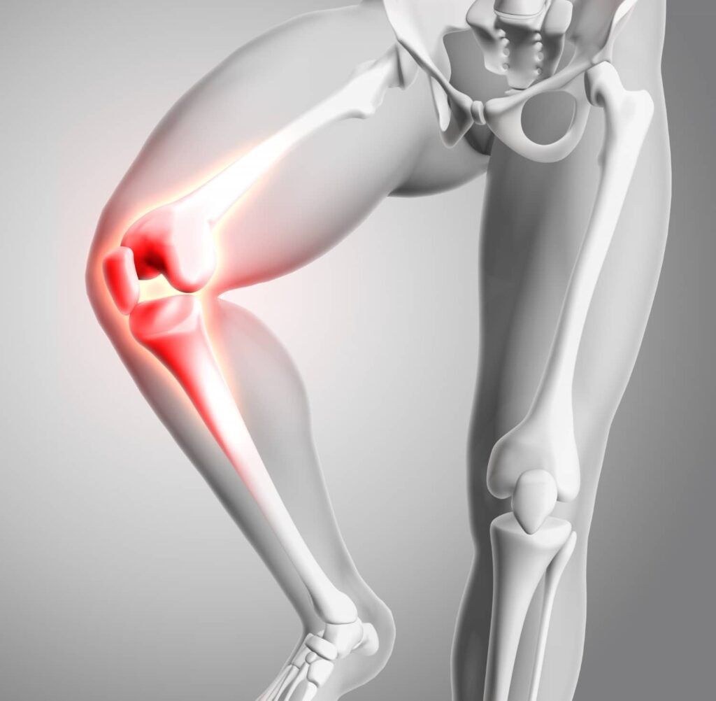 3d render medical figure with close up knee glowing bones 1
