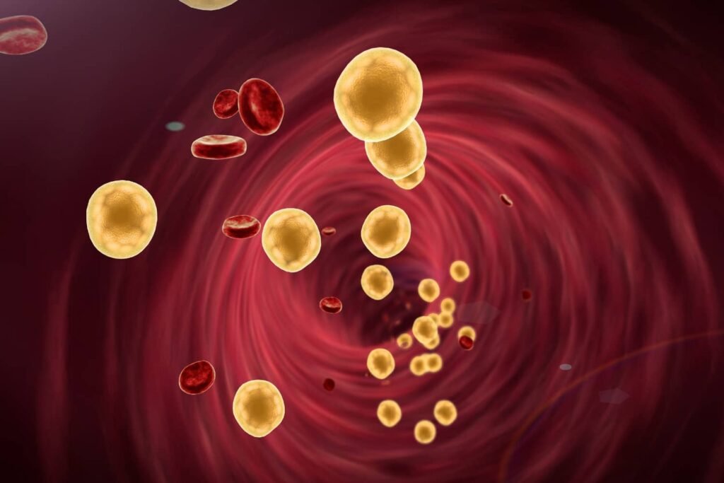 Dyslipidaemia High Cholesterol and Triglycerides