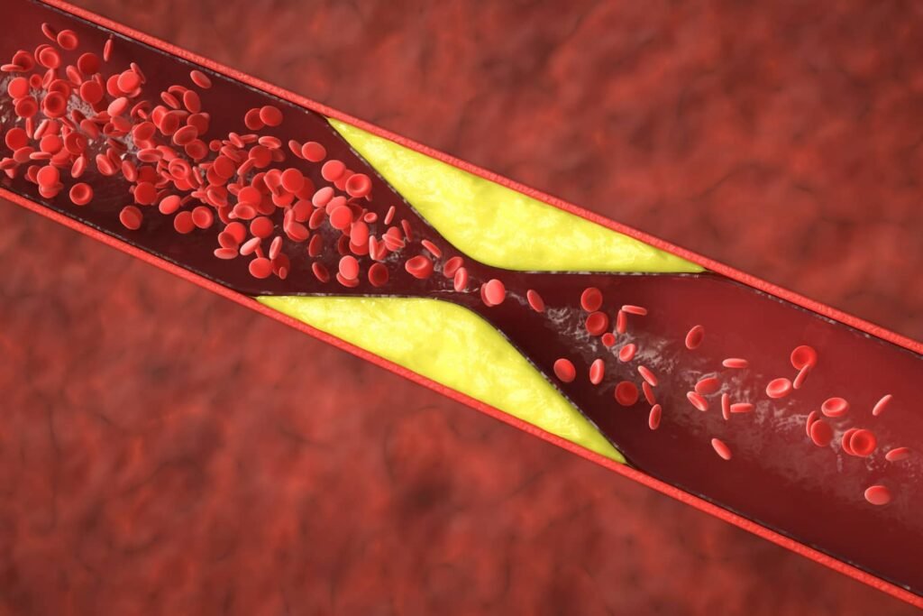 Vascular Disorders